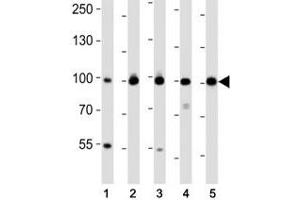 Western blot analysis of lysate from (1) MDA-MB-468, (2) SW620, (3) T47D cell line, (4) mouse spleen, (5) mouse testis tissue using EZH2 antibody at 1:1000.