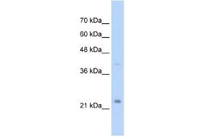MUC1 antibody used at 2. (MUC1 antibody  (C-Term))