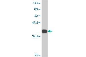 Western Blot detection against Immunogen (37. (TNFRSF11A antibody  (AA 31-130))