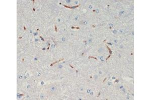 Immunohistochemistry of paraffin-embedded Mouse spinal cord using THBS1 Polyclonal Antibody at dilution of 1:200 (40x lens). (Thrombospondin 1 antibody)