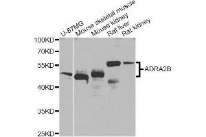 Western blot analysis of extracts of various cell lines, using ADRA2B Antibody (ABIN5996019) at 1/1000 dilution.
