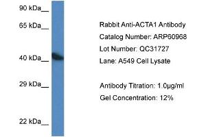 Western Blotting (WB) image for anti-Actin, alpha 1, Skeletal Muscle (ACTA1) (C-Term) antibody (ABIN2788635) (Actin antibody  (C-Term))