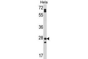 Image no. 1 for anti-Family with Sequence Similarity 3, Member B (FAM3B) (N-Term) antibody (ABIN452988) (FAM3B antibody  (N-Term))