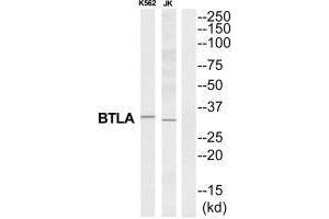 Western blot analysis of extracts from K562/Jurkat cells, using BTLA antibody. (BTLA antibody  (C-Term))