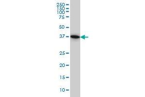 PGGT1B monoclonal antibody (M02), clone 5E4 Western Blot analysis of PGGT1B expression in HeLa .
