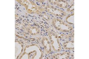 Immunohistochemistry of paraffin-embedded human kidney using ATP6AP1 antibody at dilution of 1:200 (x400 lens).