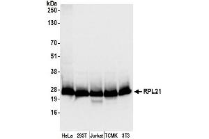 anti-Ribosomal Protein L21 (RPL21) (AA 110-160) antibody