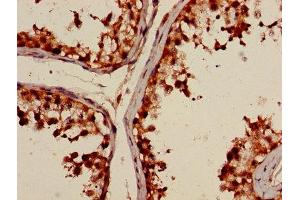 Immunohistochemistry of paraffin-embedded human testis tissue using ABIN7150251 at dilution of 1:100 (POLI antibody  (AA 458-711))