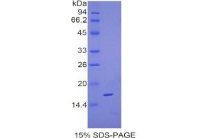 SDS-PAGE analysis of Mouse Complexin 2 Protein. (CPLX2 Protein)
