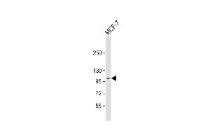 Anti-DDR1 Antibody (N-term) at 1:2000 dilution + MCF-7 whole cell lysate Lysates/proteins at 20 μg per lane. (DDR1 antibody  (N-Term))