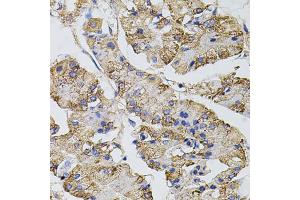Immunohistochemistry of paraffin-embedded human stomach using CAST antibody. (Calpastatin antibody)