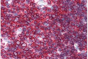 Human Thymus (formalin-fixed, paraffin-embedded) stained with SPN antibody ABIN351514 at 10 ug/ml followed by biotinylated anti-mouse IgG secondary antibody ABIN481714, alkaline phosphatase-streptavidin and chromogen. (CD43 antibody)