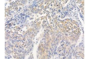 anti-Enhancer of mRNA Decapping 4 (EDC4) (C-Term) antibody