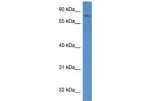 Image no. 1 for anti-Protein O-Linked Mannose Beta1,2-N-Acetylglucosaminyltransferase (POMGNT1) (AA 47-96) antibody (ABIN6746294) (POMGNT1 antibody  (AA 47-96))