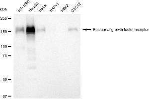 Western blotting analysis using epidermal growth factor receptor antibody (ABIN7798478). (Recombinant EGFR antibody)