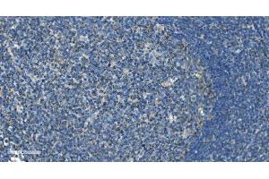 IHC analysis of IL37 using anti-IL37 antibody (ABIN7601794). (IL-37 antibody  (AA 46-218))