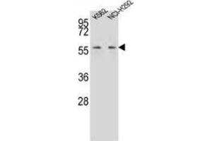 Western blot analysis in K562,NCI-H292 cell line lysates (35ug/lane) using MPP3 Antibody (C-term). (MPP3 antibody  (C-Term))