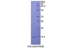 SDS-PAGE (SDS) image for Signal Transducer and Activator of Transcription 3 (Acute-Phase Response Factor) (STAT3) (AA 576-678) protein (His tag) (ABIN4991135)