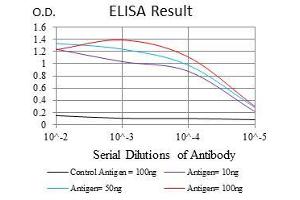 Black line: Control Antigen (100 ng), Purple line: Antigen(10 ng), Blue line: Antigen (50 ng), Red line: Antigen (100 ng), (NEFL antibody)