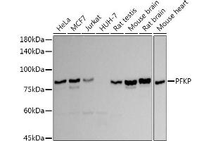 Western blot analysis of extracts of various cell lines, using PFKP antibody (ABIN7269309) at 1:1000 dilution.