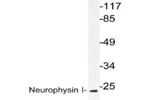 Western blot analysis of Neurophysin I Antibody in extracts from K562 cells. (OXT antibody)