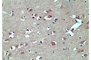 Image no. 1 for anti-TAR (HIV-1) RNA Binding Protein 2 (TARBP2) (AA 340-390) antibody (ABIN207742) (TARBP2 antibody  (AA 340-390))