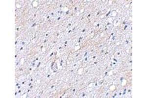Immunohistochemical staining of human brain tissue using BAIAP3 polyclonal antibody  at 5 ug/mL . (BAIAP3 antibody  (N-Term))