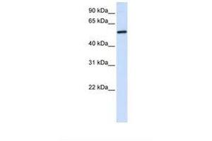 Image no. 1 for anti-Aminolevulinate, delta-, Synthase 2 (ALAS2) (AA 470-519) antibody (ABIN6737992) (ALAS2 antibody  (AA 470-519))