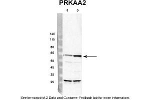 Sample Type: rat hepatocyte (50ug)Priamry Dilution: 1:4000Secondary Antibody: Donkey anti-Rabbit HRPSecondary Dilution: 1:10,000Image Submitted By: Dustin Singer,INRA/AgroParistech (PRKAA2 antibody  (Middle Region))