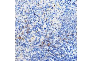 Immunohistochemistry of paraffin-embedded mouse spleen using IL24 Rabbit pAb (ABIN6128082, ABIN6142368, ABIN6142369 and ABIN6219012) at dilution of 1:100 (40x lens). (IL-24 antibody  (AA 52-140))