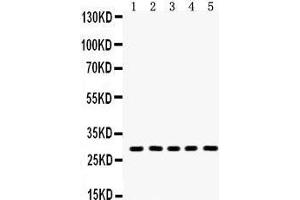 Anti- Aquaporin 1 Picoband antibody, Western blotting All lanes: Anti Aquaporin 1  at 0. (Aquaporin 1 antibody  (C-Term))