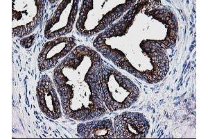 Image no. 3 for anti-Deoxythymidylate Kinase (Thymidylate Kinase) (DTYMK) antibody (ABIN1497918) (DTYMK antibody)