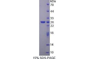 Image no. 1 for Nephroblastoma Overexpressed (NOV) (AA 156-351) protein (His tag) (ABIN6238128) (NOV Protein (AA 156-351) (His tag))