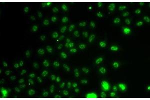 Immunofluorescence analysis of A549 cells using ETV1 Polyclonal Antibody (ETV1 antibody)