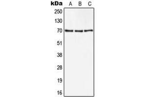 Western blot analysis of CD105 expression in Hela (A), A549 (B), NIH3T3 (C) whole cell lysates.