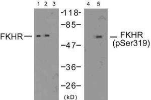 Western blot analysis of extracts from 293 cells (10% serum-treated, 15min) and HeLa cells (EGF-treated, 200ng/ml, 15min), using FKHR (Ab-319) antibody (E021161, Lane 1, 2 and 3) and FKHR (phospho-Ser319) antibody (E011136, Lane 4 and 5). (FOXO1 antibody  (pSer319))