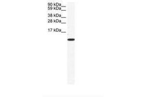 Image no. 1 for anti-Chemokine (C-C Motif) Ligand 5 (CCL5) (AA 26-75) antibody (ABIN202013) (CCL5 antibody  (AA 26-75))