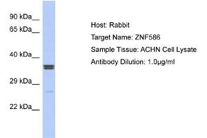 Host: Rabbit Target Name: ZNF586 Sample Type: ACHN Whole cell lysates Antibody Dilution: 1. (ZNF586 antibody  (Middle Region))
