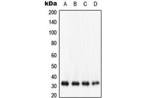 Western blot analysis of NQO1 expression in HepG2 (A), SW480 (B), HCT 116 (C), K562 (D) whole cell lysates. (NQO1 antibody  (C-Term))