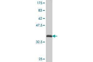 Western Blot detection against Immunogen (37. (ZNF131 antibody  (AA 139-238))