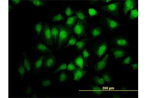 Immunofluorescence of monoclonal antibody to EHD2 on HeLa cell. (EHD2 antibody  (AA 365-427))