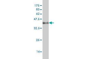 Western Blot detection against Immunogen (38. (DLX2 antibody  (AA 1-110))