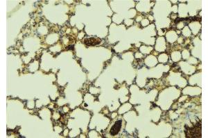 ABIN6277517 at 1/100 staining Mouse lung tissue by IHC-P. (PDZK1 antibody  (C-Term))