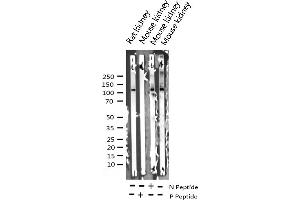 Western blot analysis of Phospho-FAK (Tyr925) expression in various lysates (FAK antibody  (pTyr925))