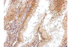 Immunohistochemistry (IHC) image for anti-Epidermal Growth Factor Receptor (EGFR) (C-Term) antibody (ABIN2854754)