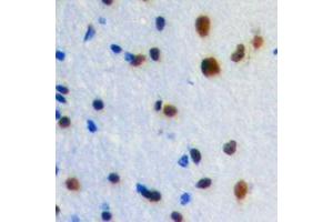 Immunohistochemical analysis of ZIC1/2/3 staining in human brain formalin fixed paraffin embedded tissue section. (ZIC1/2/3 antibody  (Center))