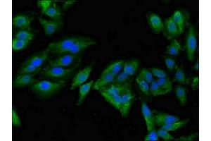 Immunofluorescent analysis of Hela cells using ABIN7143899 at dilution of 1:100 and Alexa Fluor 488-congugated AffiniPure Goat Anti-Rabbit IgG(H+L) (alpha-Mannosidase II antibody  (AA 31-181))