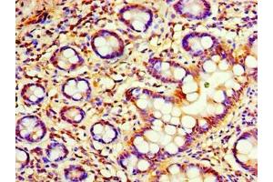 Immunohistochemistry of paraffin-embedded human small intestine tissue using ABIN7174852 at dilution of 1:100 (C4ORF3 antibody  (AA 1-44))