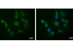 ICC/IF Image SLU7 antibody detects SLU7 protein at cytoplasm and nucleus by immunofluorescent analysis.