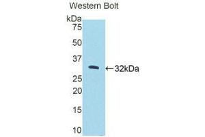 Western Blotting (WB) image for anti-Protein Kinase N2 (PKN2) (AA 67-312) antibody (ABIN1175309)